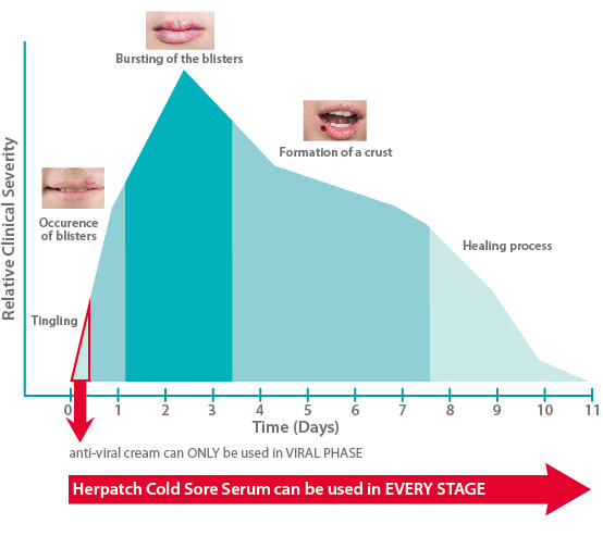 stages-of-a-blister-outbreak_en