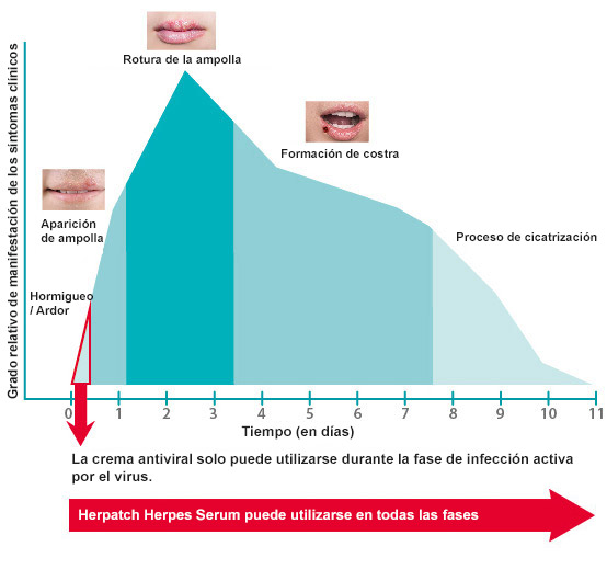 stages-of-a-blister-outbreak