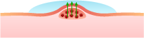 herpatch-applied